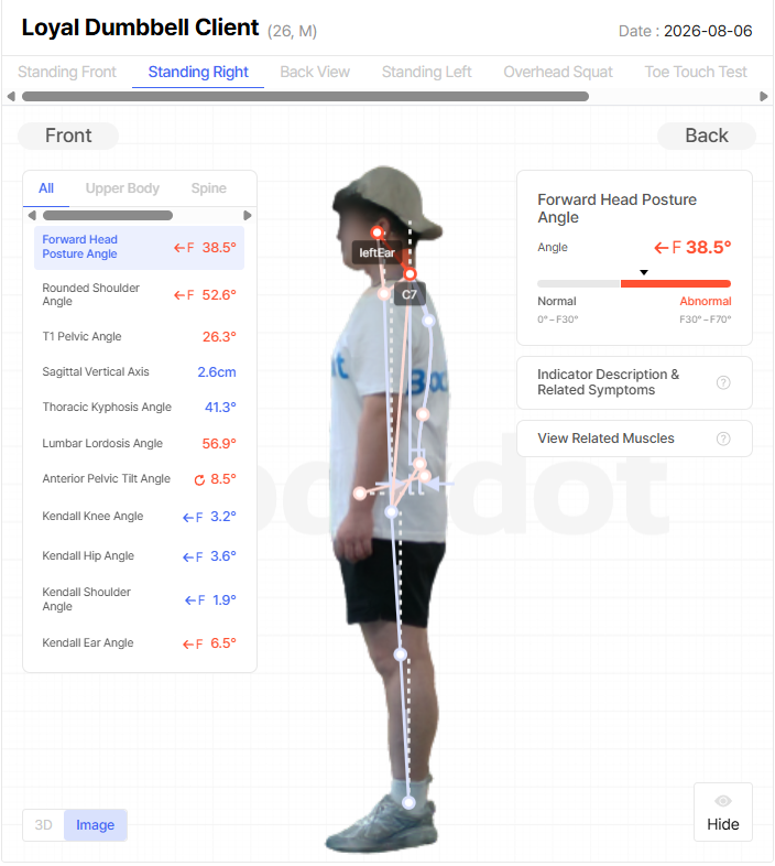 Body Analysis Results - Forward Head Posture Angle
